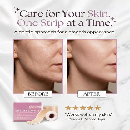 Scarvia™ - Collagen Scar Sheets